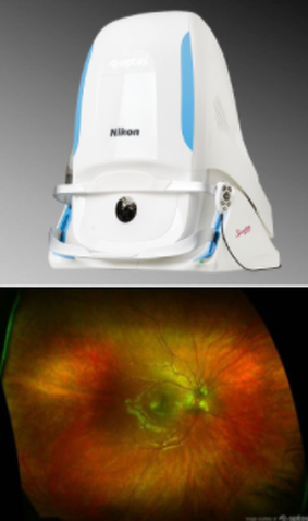 Optomap device and imaging of eye